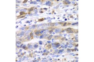 Immunohistochemistry (Paraffin-embedded Sections) (IHC (p)) image for anti-Ubiquitin-Conjugating Enzyme E2C (UBE2C) (AA 1-179) antibody (ABIN6149787)