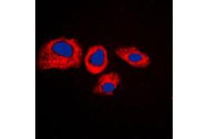 Immunofluorescent analysis of RPS4Y1 staining in K562 cells.
