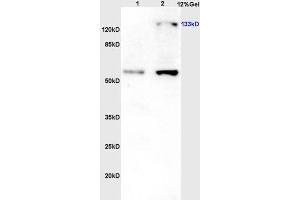Lane 1: Rat brain lysates; Lane 2: Rat liver lysates probed with Rabbit Anti-eNOS (Thr113) Polyclonal Antibody (ABIN701245) at 1:300 overnight in 4 °C. (ENOS Antikörper  (pThr113))