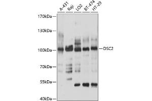 Western blot analysis of extracts of various cell lines, using DSC2 antibody (ABIN6127802, ABIN6139827, ABIN6139828 and ABIN6214372) at 1:1000 dilution. (Desmocollin 2 Antikörper  (AA 520-690))