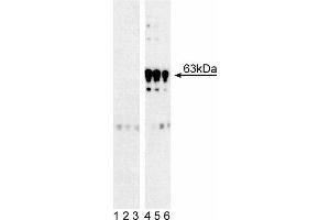 Western blot analysis of PDPK1 (pS241) in human T lymphocytes.