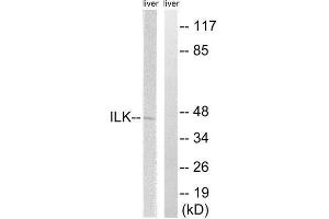 Western Blotting (WB) image for anti-Integrin-Linked Kinase (ILK) (Ser246) antibody (ABIN1848219) (ILK Antikörper  (Ser246))