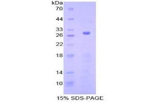 SDS-PAGE analysis of Human Adenylate Cyclase 5 Protein. (ADCY5 Protein)