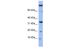 WB Suggested Anti-FAM178B Antibody Titration: 0. (FAM178B Antikörper  (Middle Region))