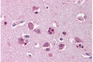 Human Brain, Cortex (formalin-fixed, paraffin-embedded) stained with HOMER1 antibody ABIN214115 at 5 ug/ml followed by biotinylated goat anti-rabbit IgG secondary antibody ABIN481713, alkaline phosphatase-streptavidin and chromogen. (HOMER1 Antikörper  (AA 101-150))