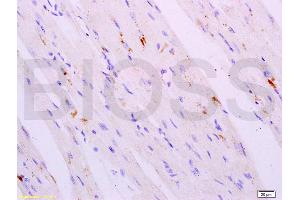 Formalin-fixed and paraffin embedded mouse heart tissue labeled with Anti-Cathepsin K Polyclonal Antibody, Unconjugated (ABIN732038) at 1:200 followed by conjugation to the secondary antibody, (SP-0023), and DAB staining (Cathepsin K Antikörper)