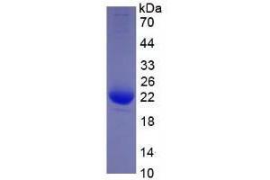 Image no. 1 for Interleukin 1, beta (IL1B) (AA 117-269) (Active) protein (His tag) (ABIN6239741)