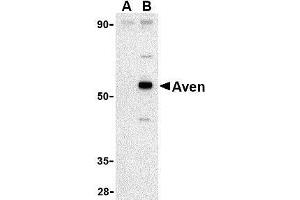 Western blot analysis of Aven in Raji cell lysate with AP30098PU-N Aven antibody at 1 μg/ml in (A) the presence and (B) the absence of blocking peptide. (AVEN Antikörper  (C-Term))