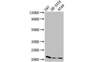 Western Blot Positive WB detected in: U87 whole cell lysate, SH-SY5Y whole cell lysate, A549 whole cell lysate All lanes: NDUFS4 antibody at 2. (NDUFS4 Antikörper  (AA 43-161))