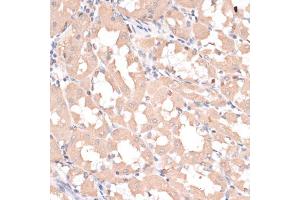 Immunohistochemistry of paraffin-embedded human stomach using ABCC1 antibody (ABIN6291733) at dilution of 1:100 (40x lens). (ABCC1 Antikörper)