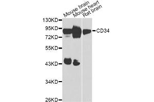 Western blot analysis of extracts of various cell lines, using CD34 Antibody (ABIN5975528) at 1/1000 dilution. (CD34 Antikörper)