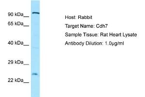 WB Suggested Anti-Cdh7 Antibody   Titration: 1. (Cadherin 7 Antikörper  (N-Term))