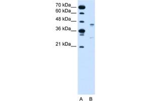 Western Blotting (WB) image for anti-G Protein-Coupled Receptor 161 (GPR161) antibody (ABIN2462573) (GPR161 Antikörper)