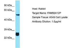 Host: Rabbit Target Name: FAM90A12P Sample Tissue: Human A549 Whole Cell Antibody Dilution: 1ug/ml (FAM90A12P Antikörper  (Middle Region))