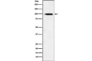 Western blot analysis of GIT1 expression in 293T cell lysate.