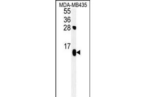 ATP5D Antibody (N-term) (ABIN652148 and ABIN2840566) western blot analysis in MDA-M cell line lysates (35 μg/lane). (ATP5F1D Antikörper  (N-Term))