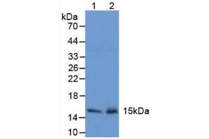 Western blot analysis of (1) Mouse Stomach Tissue and (2) Mouse Pancreas Tissue.