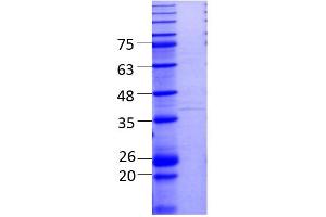SDS-PAGE (SDS) image for LINE1 Retrotransposable Element 1 (L1RE1) (AA 1-338) protein (Strep Tag) (ABIN3083185)