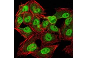 Immunocytochemistry (ICC) image for anti-Chromobox Homolog 1 (CBX1) (AA 1-185) antibody (ABIN5890956) (CBX1 Antikörper  (AA 1-185))