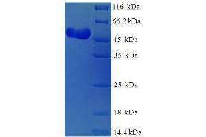 SDS-PAGE (SDS) image for Polymerase (DNA Directed), gamma (POLG) (AA 575-866) protein (His-SUMO Tag) (ABIN5711081)
