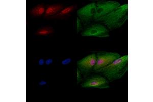 ABIN6260274 and ABIN6272782 staining  cells by IF/ICC. (ARNTL Antikörper  (Internal Region))