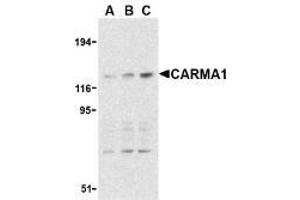 Western blot analysis of CARMA1 expression in mouse thymus cell lysate with AP30186PU-N CARMA1 antibody at 0. (CARD11 Antikörper)