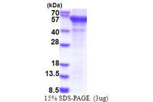 SDS-PAGE (SDS) image for PCI Domain Containing 2 (PCID2) (AA 80-399) protein (His tag) (ABIN5853867)
