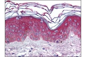 Image no. 1 for anti-rho Guanine Nucleotide Exchange Factor (GEF) 11 (ARHGEF11) (AA 1-50), (N-Term) antibody (ABIN372272)