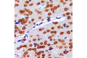 Immunohistochemical analysis of GPRIN2 staining in human brain formalin fixed paraffin embedded tissue section. (GPRIN2 Antikörper  (N-Term))