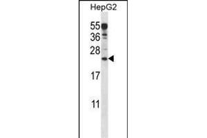 ANKRD22 Antibody (C-term) (ABIN657584 and ABIN2846587) western blot analysis in HepG2 cell line lysates (35 μg/lane). (ANKRD22 Antikörper  (C-Term))