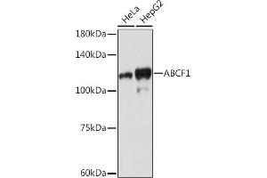 Western blot analysis of extracts of various cell lines, using  Rabbit mAb (ABIN7265740) at 1:1000 dilution.