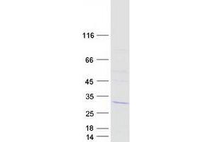 Validation with Western Blot (LSM12B Protein (Myc-DYKDDDDK Tag))