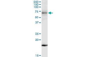 TNK2 MaxPab rabbit polyclonal antibody. (TNK2 Antikörper  (AA 1-352))