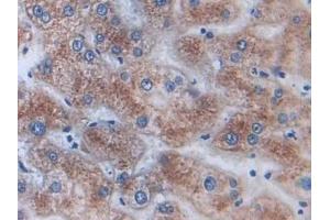 Immunohistochemistry (IHC) image for anti-A Kinase (PRKA) Anchor Protein 11 (AKAP11) (AA 1650-1901) antibody (ABIN7443557)