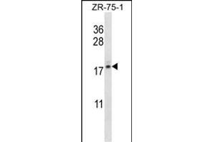 TNP2 Antibody (C-term) (ABIN656736 and ABIN2845960) western blot analysis in ZR-75-1 cell line lysates (35 μg/lane). (TNP2 Antikörper  (C-Term))