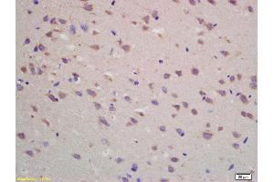Formalin-fixed and paraffin embedded rat brain labeled with Rabbit Anti ADORA1 Polyclonal Antibody, Unconjugated (ABIN705656) at 1:200 followed by conjugation to the secondary antibody and DAB staining (ADORA1 Antikörper  (AA 151-250))