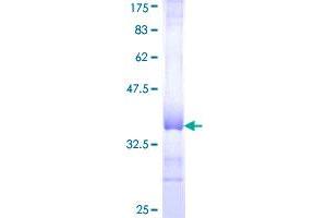 COL16A1 Protein (AA 117-216) (GST tag)