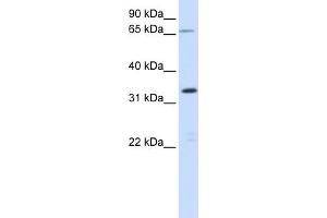 WB Suggested Anti-C19orf47 Antibody Titration:  0.