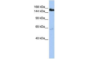 WB Suggested Anti-TNKS Antibody Titration:  1 ug/ml  Positive Control:  HepG2 cell lysate (TNKS Antikörper  (Middle Region))