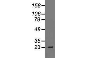 Western blot analysis of 35 µg of cell extracts from human Liver carcinoma (HepG2) cells using anti-TNNI3 antibody. (TNNI3 Antikörper)
