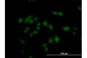 Immunofluorescence of monoclonal antibody to CARF on HeLa cell.