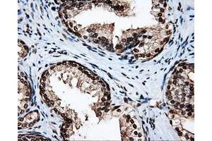 Image no. 3 for anti-Amyloid beta (A4) Precursor Protein (APP) antibody (ABIN1496877) (APP Antikörper)