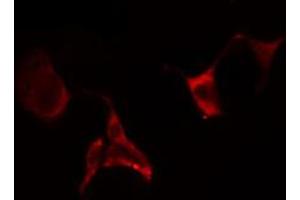 ABIN6274649 staining Hela cells by IF/ICC. (CYP2E1 Antikörper  (Internal Region))