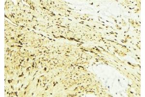 ABIN6276577 at 1/100 staining Mouse muscle tissue by IHC-P. (FAAH Antikörper)
