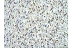 Rabbit Anti-EXOSC7 antibody   Paraffin Embedded Tissue: Human Heart cell Cellular Data: cardiac cell of renal tubule Antibody Concentration: 4. (EXOSC7 Antikörper  (N-Term))