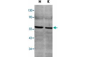 Western blot analysis of TNFRSF10B in HeLa (H) and K-562 (K) cell lysates with TNFRSF10B polyclonal antibody  at 2 ug/mL . (TNFRSF10B Antikörper  (C-Term))