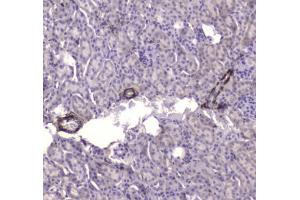IHC testing of FFPE mouse kidney tissue with CKB antibody at 1ug/ml. (CKB Antikörper)