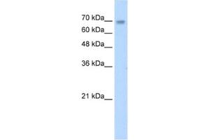 Western Blotting (WB) image for anti-Zinc Finger Protein 264 (ZNF264) antibody (ABIN2461695)