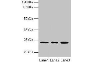 Western blot All lanes: MRPL58 antibody at 2 μg/mL Lane 1: A549 whole cell lysate Lane 2: Jurkat whole cell lysate Lane 3: K562 whole cell lysate Secondary Goat polyclonal to rabbit IgG at 1/10000 dilution Predicted band size: 24 kDa Observed band size: 24 kDa (Peptidyl-tRNA Hydrolase ICT1, Mitochondrial (AA 30-206) Antikörper)