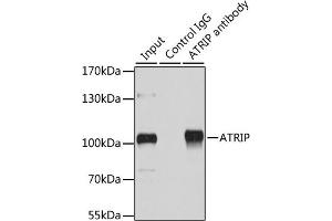 Immunoprecipitation analysis of 200 μg extracts of HeLa cells using 1 μg ATRIP antibody (ABIN1678799, ABIN3019346, ABIN3019347 and ABIN6220835). (ATRIP Antikörper  (AA 1-260))